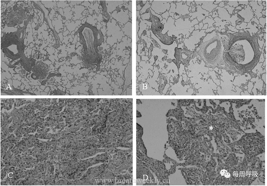 图片[9]-肺炎支原体肺炎病理与影像相关性 | 每周呼吸-每周呼吸