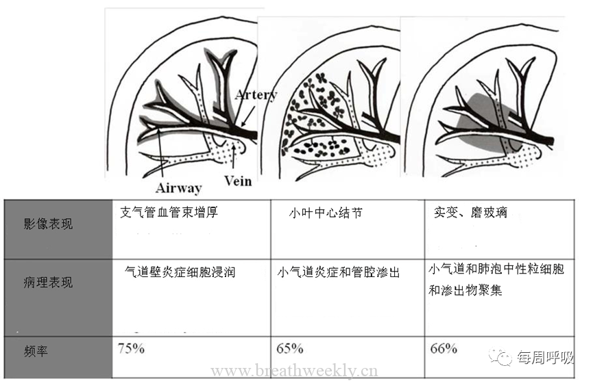 图片[10]-肺炎支原体肺炎病理与影像相关性 | 每周呼吸-每周呼吸