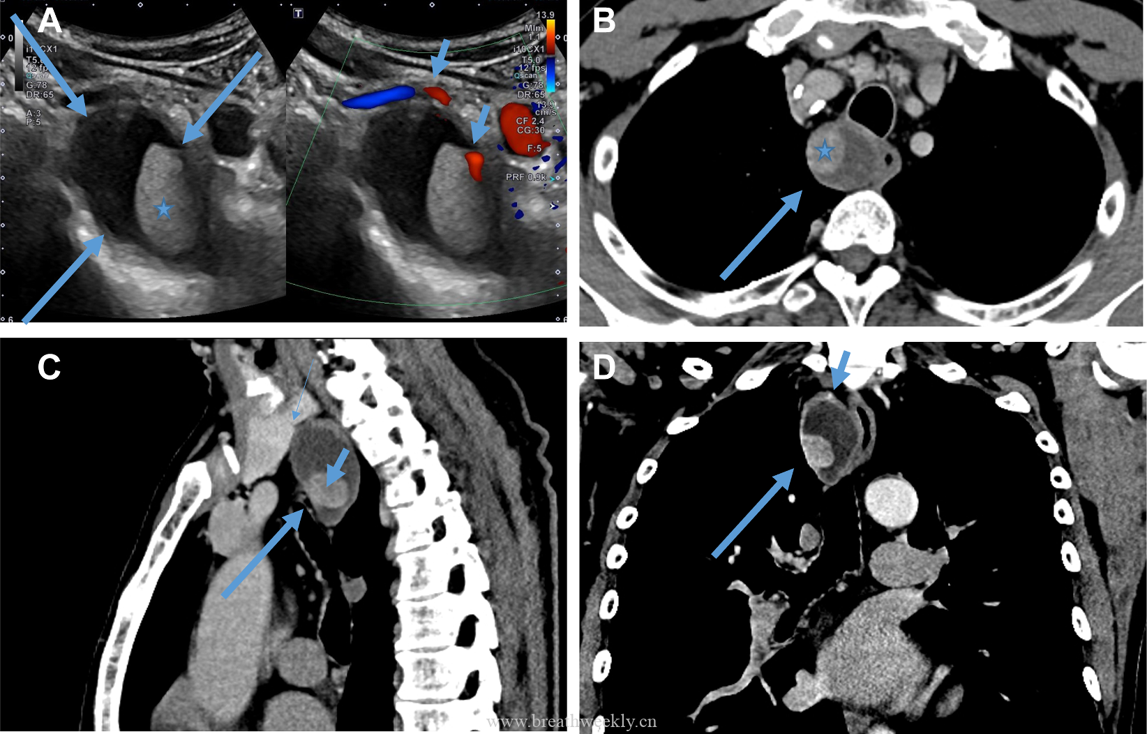 每周猜猜看第10期-每周呼吸